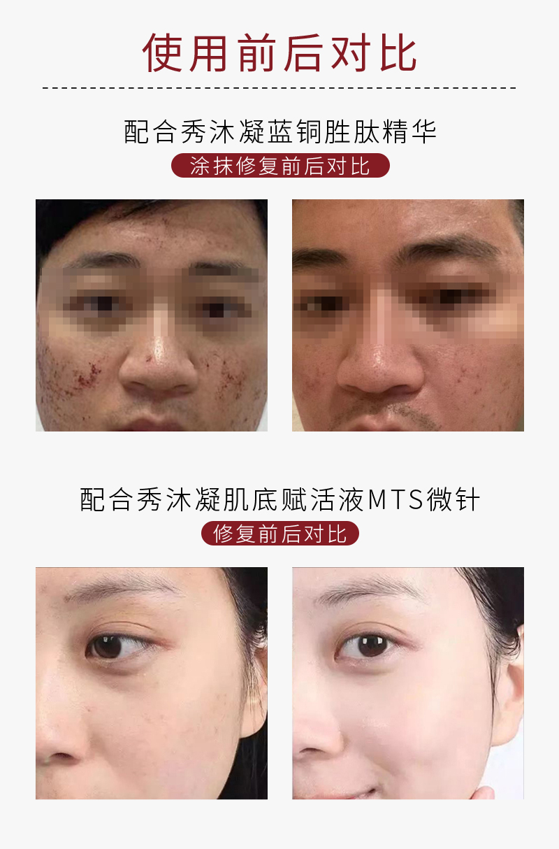 Poudre lyophilisée Therapeel Xiu Muning : -6